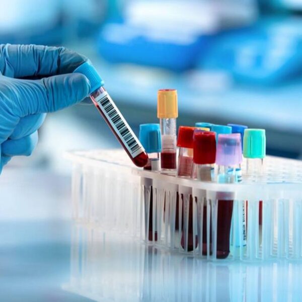 blood_test_samples_1200x750-59cd6b99366c6e716576ccd68351ed39