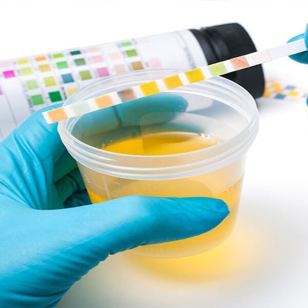 urine-test-left